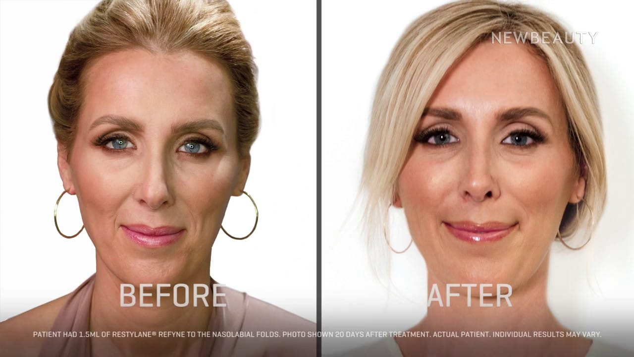 Cosmetic Injections in NJ