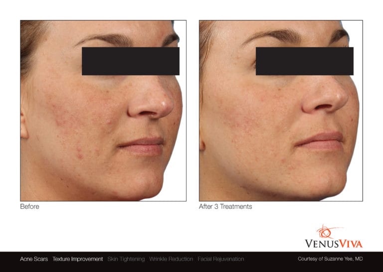 Venus Viva NYC