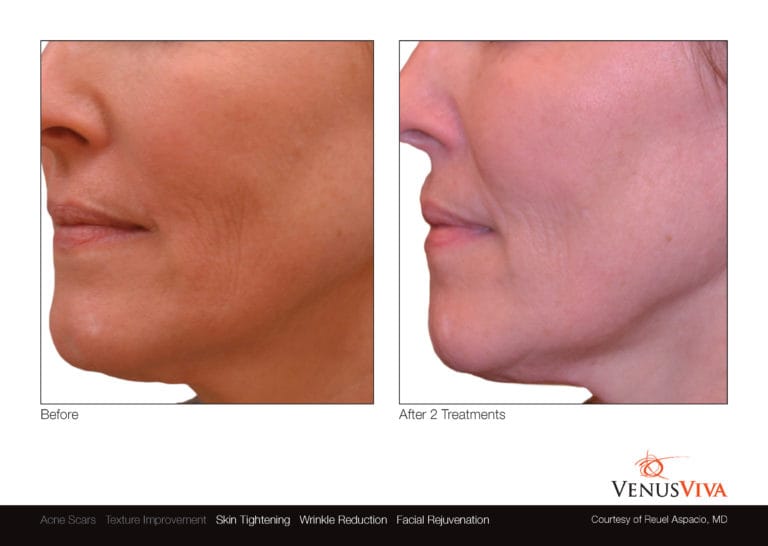 Venus Viva NYC